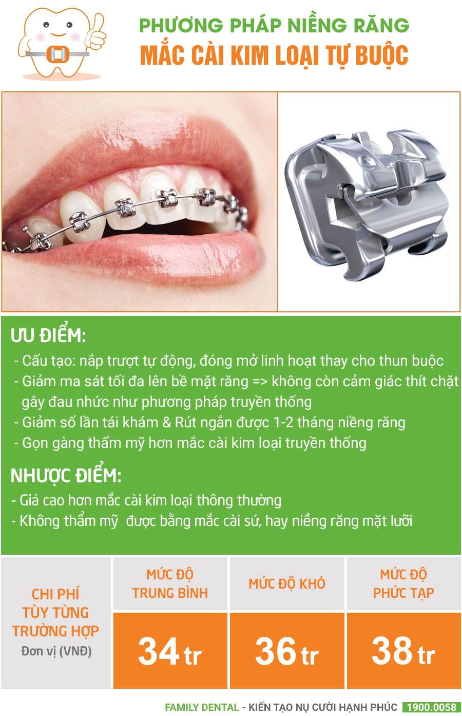 bang-gia-nieng-rang-kim-loai-tu-buoc