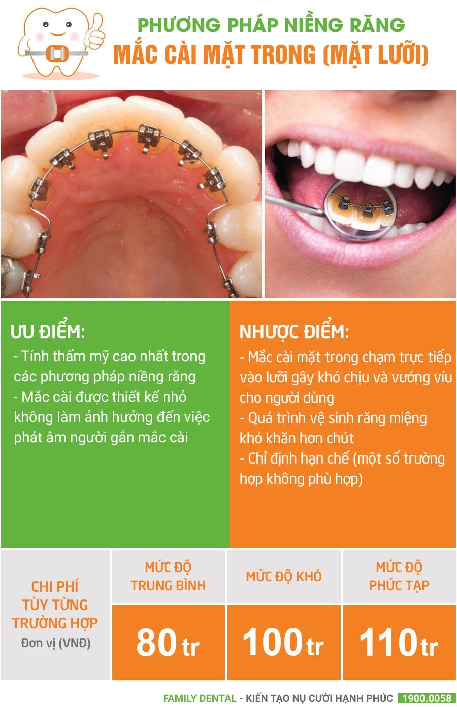 bang-gia-nieng-rang-mac-cai-mat-trong