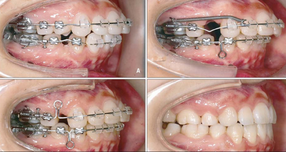 1. Khám và tư vấn ban đầu