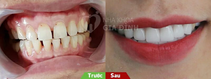 rang-thua