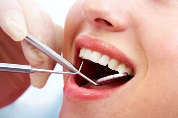 Lấy cao răng định kì để tránh bị đen chân răng