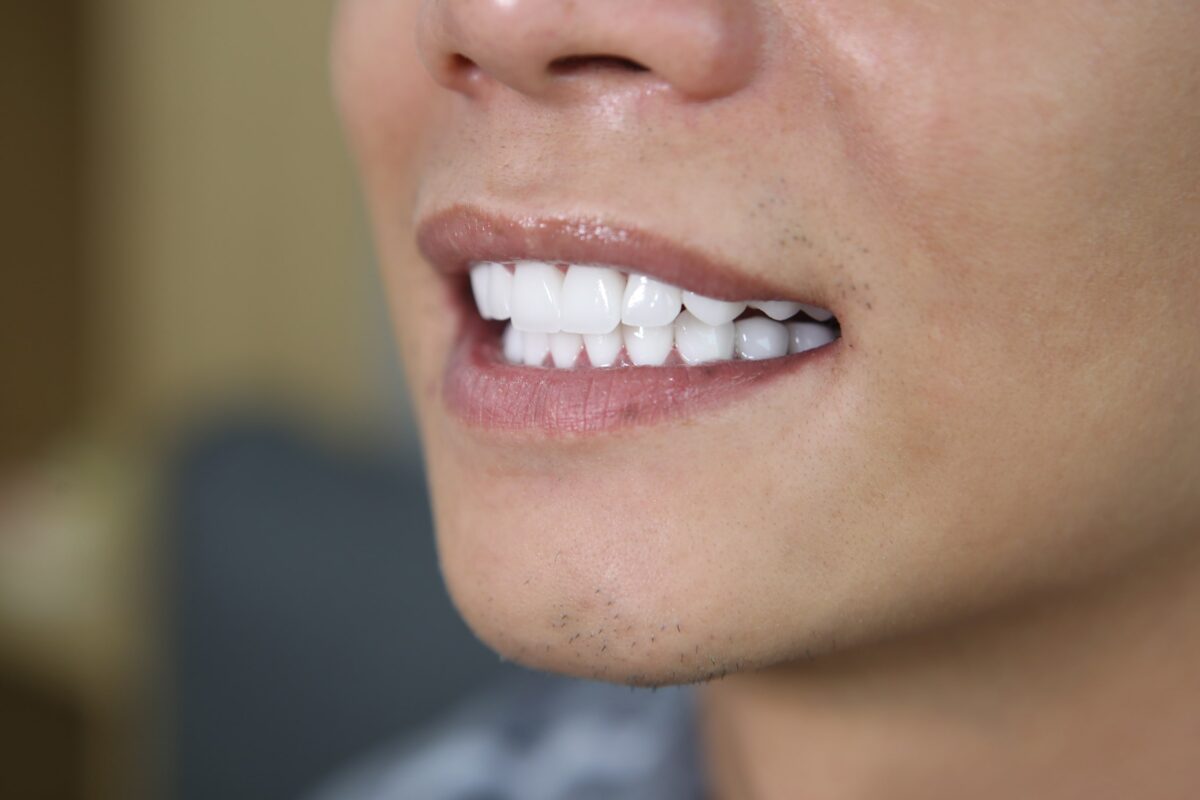  Hình thể răng đều, thẳng, phục hình mất răng bên trong cải thiện khả năng ăn nhai.