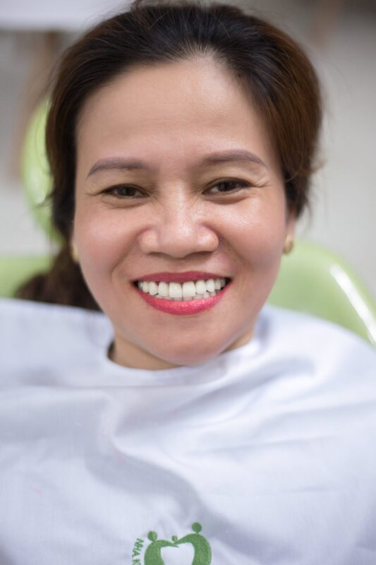 Hình ảnh cô Hà sau khi làm răng