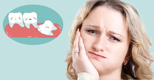 Răng khôn mọc lệch gây ra nhiều biến chứng