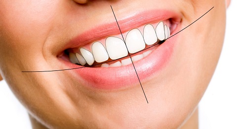 Răng, môi, nướu phải có sự cân đối và hài hòa với nhau. Khi cười, tất cả các cạnh cắn của răng hàm trên phải song song với bờ môi dưới, bờ môi trên nằm ngang đường cổ răng hàm trên.