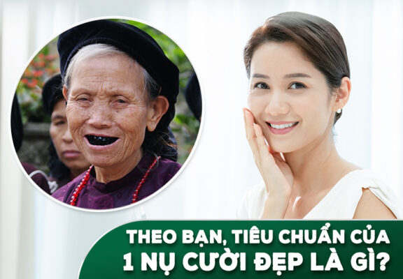 tieu chuan nu cuoi dep