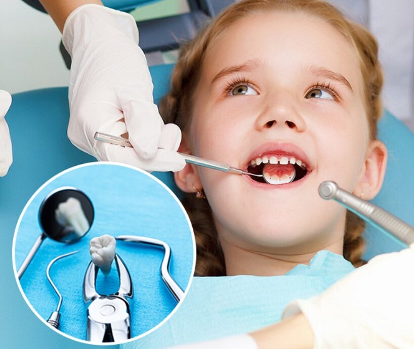 Nhổ răng sữa ở tuổi 5 có gây đau đớn cho trẻ không?
