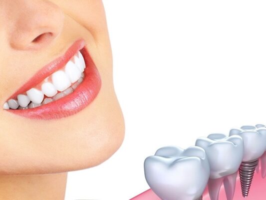 Đảm bảo sức khỏa răng miệng khi lấy cao răng