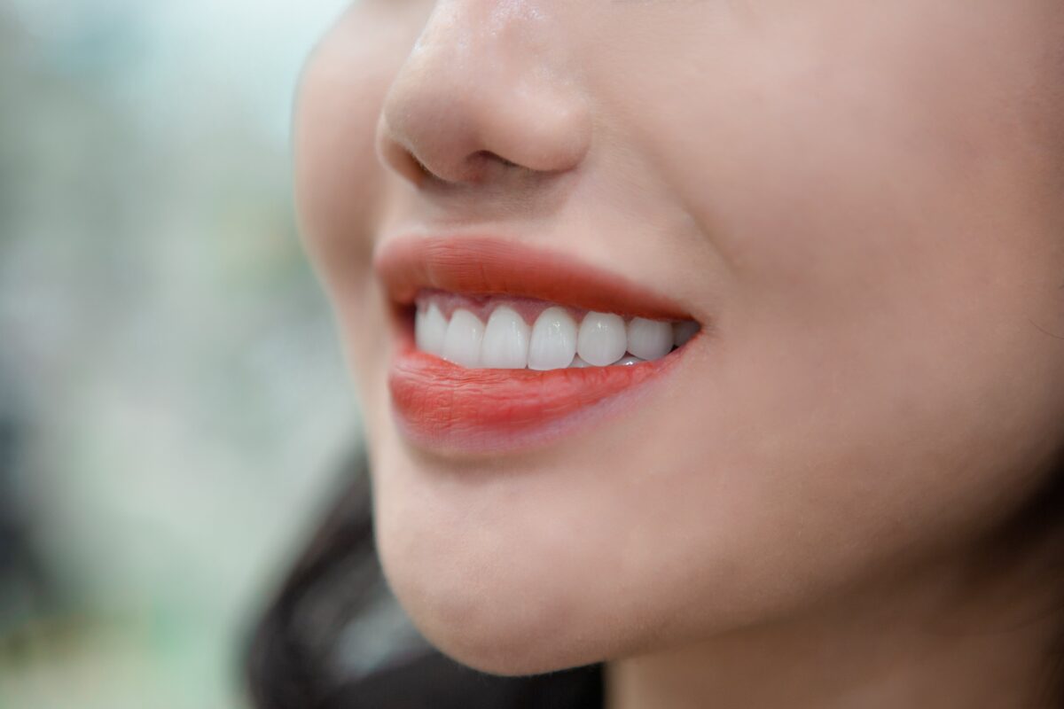 Cận cảnh hàm răng mới đẹp không tì vết
