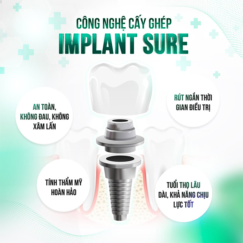 Cấy Implant sure an toàn cho người cao tuổi