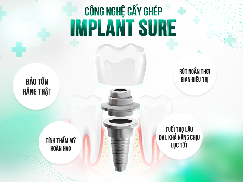 Tìm hiểu về giải pháp trồng răng implant toàn hàm 