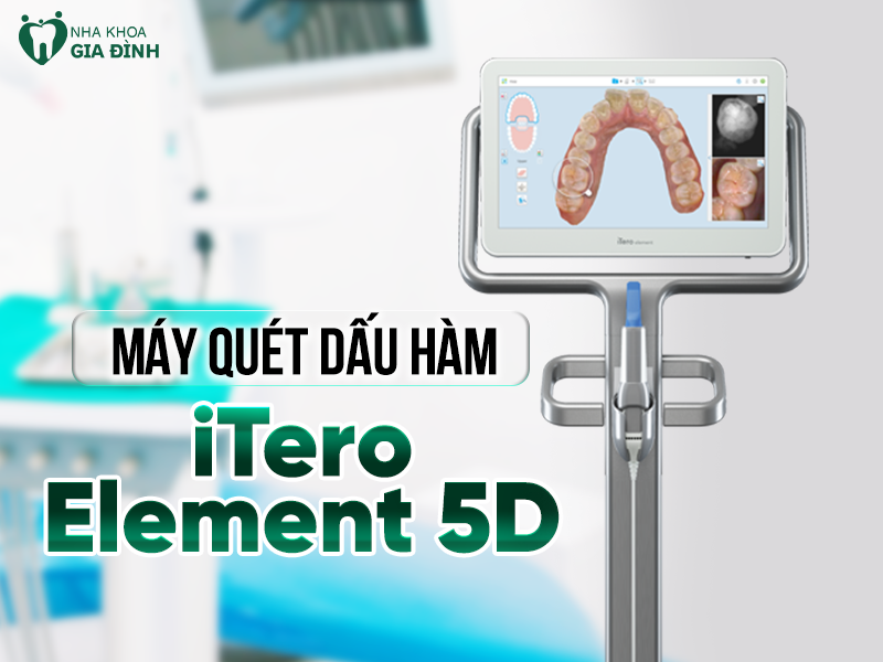Máy quét dấu hàm iTero Element 5D - Công nghệ quét lấy dấu răng hiện đại nhất thế giới