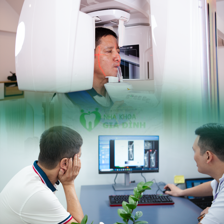 Kỹ Thuật Cấy Ghép Implant Toàn Hàm All On 6