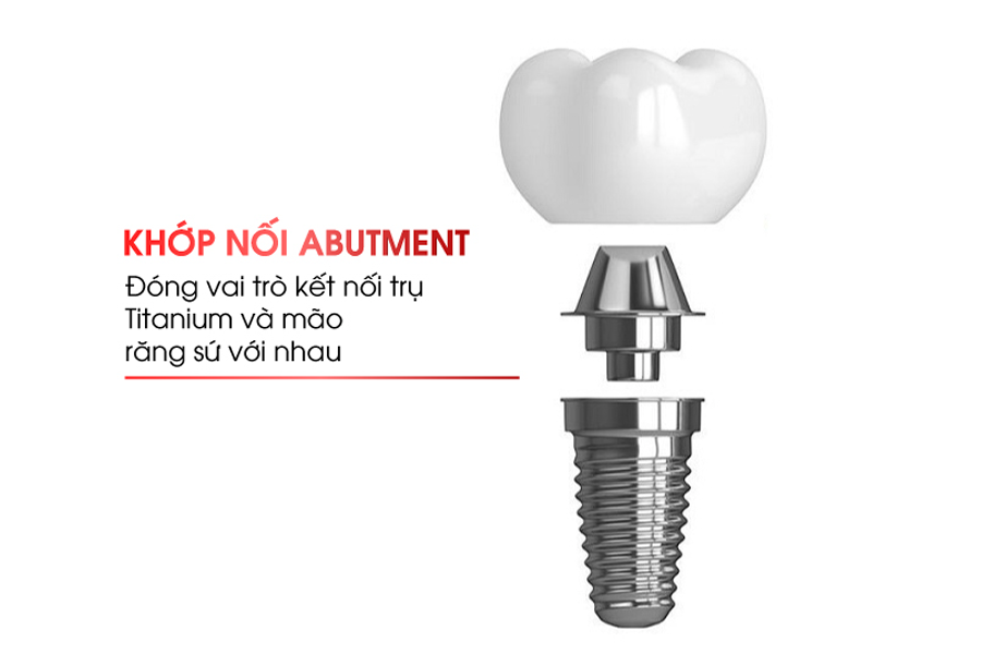 Mất Răng Lâu Năm Có Phục Hồi Được Không? Giải Pháp Nào Là Tối Ưu? W6